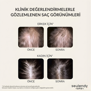 Aminexil Clinical Yenilikçi Kore Saç Dökülmesine Karşı Bakım Serumu