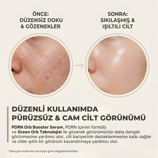 10.000 PPM PDRN Boost Sıkılaştırıcı Orb Serum
