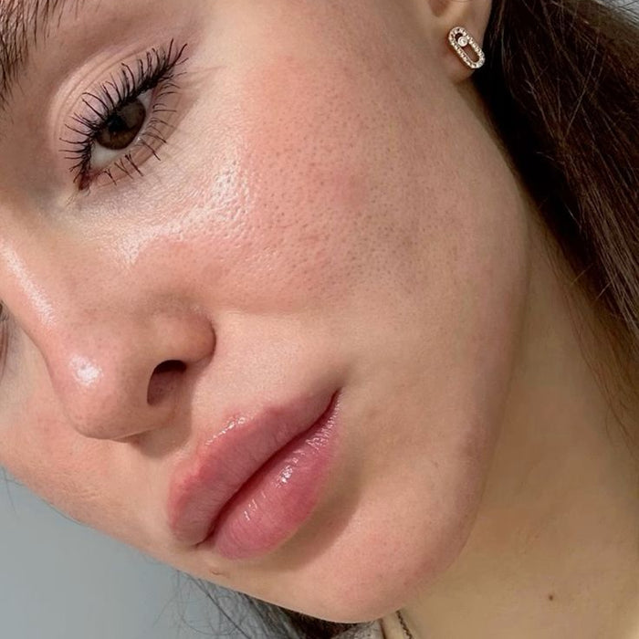 Rachel, 29